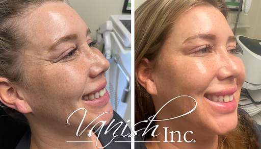 Explore jazz tattoo ideas, creative tattoo ideas in Williamsport, available at Vanish Laser & Skin, Inc.