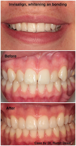 Belmont Park Dental Care - Belmont Park Dental Care