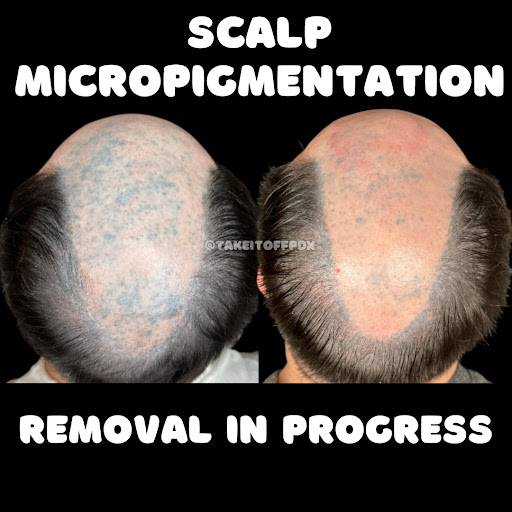 Explore me vs me tattoo ideas, creative tattoo ideas in Portland, available at Take It Off Tattoo Removal and Alt Spa