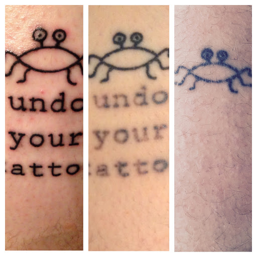 Explore philosophical tattoo ideas, creative tattoo ideas in Lawrence, available at Removery Tattoo Removal & Fading