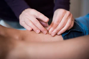 Cardiff Acupuncture Clinic image