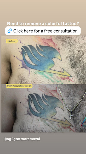 Explore tool band tattoo ideas, creative tattoo ideas in New York, available at Ag2g Laser Tattoo Removal & MedSpa