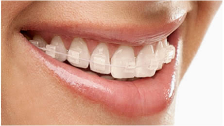 Ortodoncia y Estética Dental