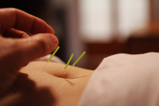 Acupuncture For Women's Health