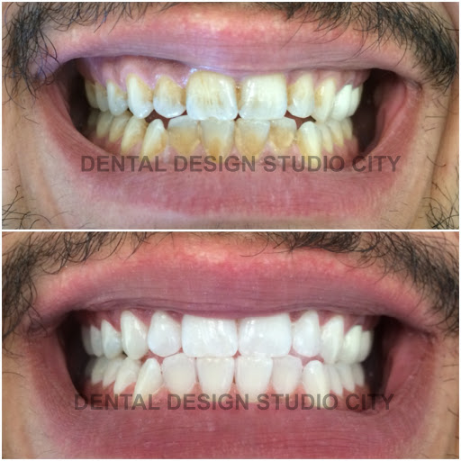 Dental Design Studio City image