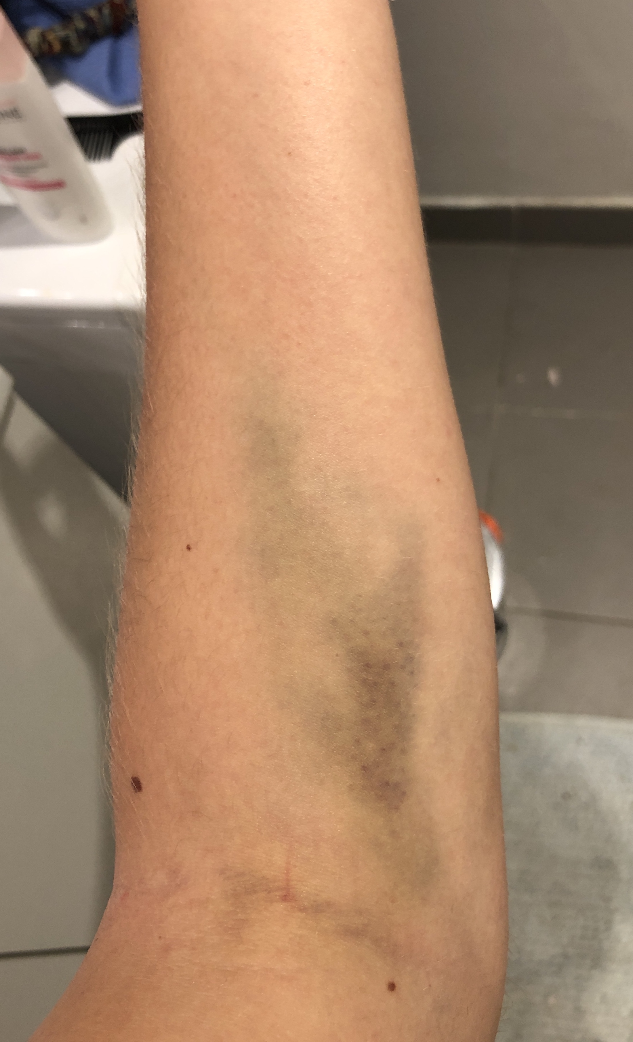 Photo n° 1 de l'avis de Lise.i fait le 20/10/2020 à 06:31