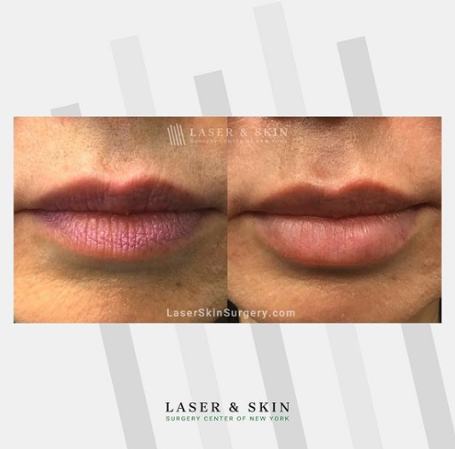 Explore twin tattoo ideas for mom, creative tattoo ideas in Southampton, available at Laser & Skin Surgery Center of New York - Southampton