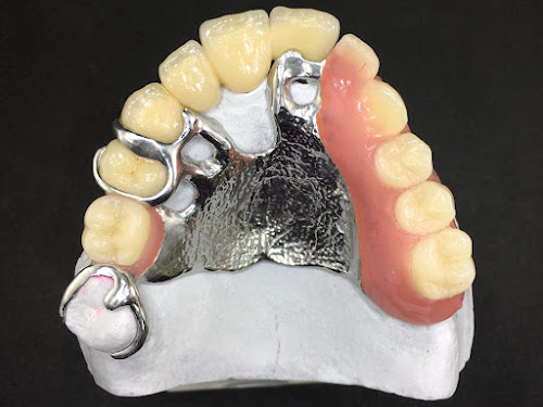 Centre de prothèses dentaires Laboratoire Prothèses Dentaires Chauvin Lacroix-Falgarde