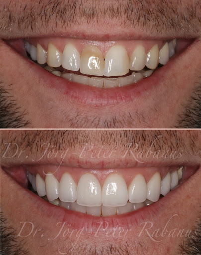 Dr. Jorg-Peter Rabanus, DDS