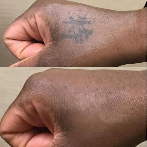 Explore bg3 tattoo ideas, creative tattoo ideas in Houston, available at Removery Tattoo Removal & Fading