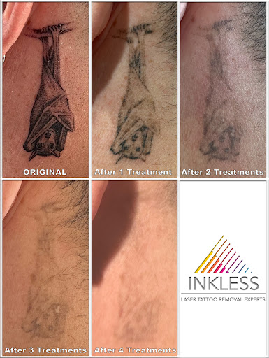 Explore tattoo ideas for the wrist females, creative tattoo ideas in Denver, available at Inkless Tattoo Removal