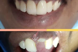 מרפאת שיניים בפתח תקווה: רופא שיניים בפתח תקווה ד"ר עמוס בוחניק image