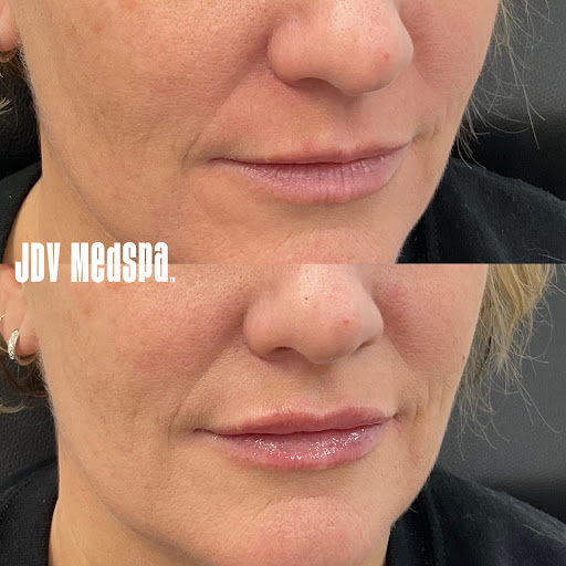 Explore forearm tattoo ideas girl, creative tattoo ideas in Canton, available at JDV Med Spa