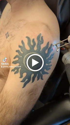 Explore art deco tattoo ideas, creative tattoo ideas in Reno, available at Reno Tattoo Removal