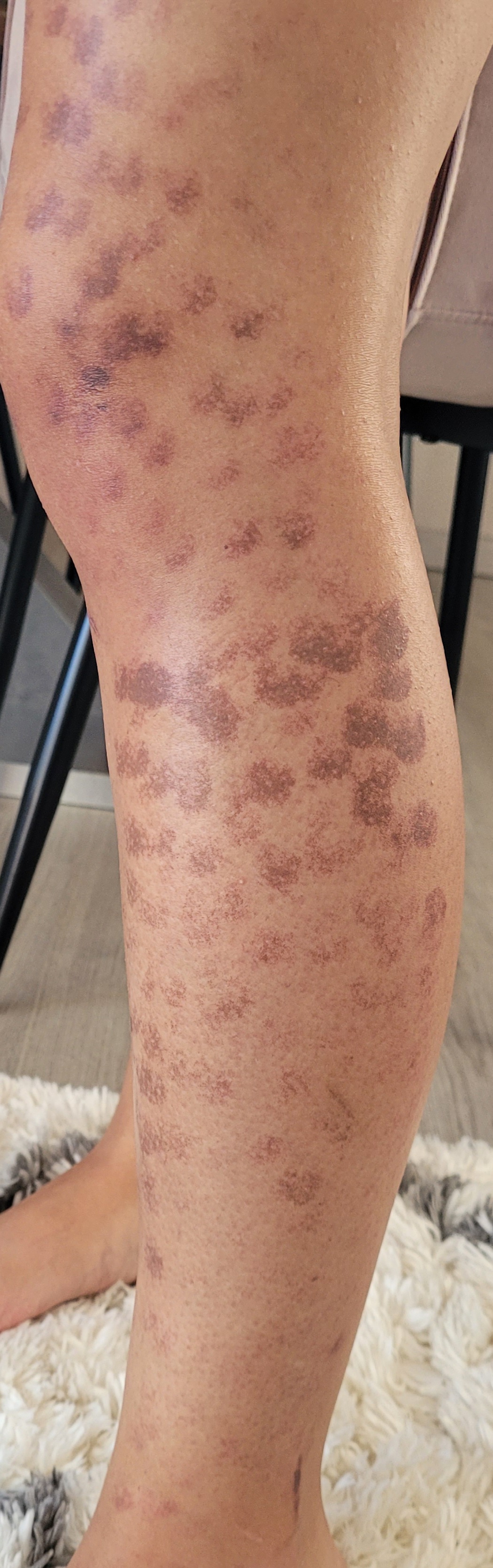 Photo n° 2 de l'avis de Hatice.k fait le 17/05/2021 à 09:06