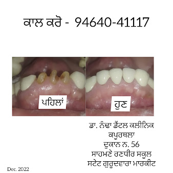 Dr Nandha Dental Clinic And Implant Centre - Dr Nandha Dental Clinic And Implant Centre