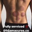 Hijama Clinic and Training Centre