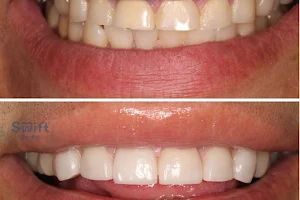 Tijuana Dentist | Clinica Dental Integral image