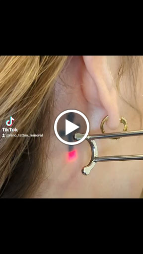 Explore emily tattoo ideas, creative tattoo ideas in Reno, available at Reno Tattoo Removal