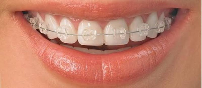 Opiniones de Dental Mendoza en Nuevo Chimbote - Dentista