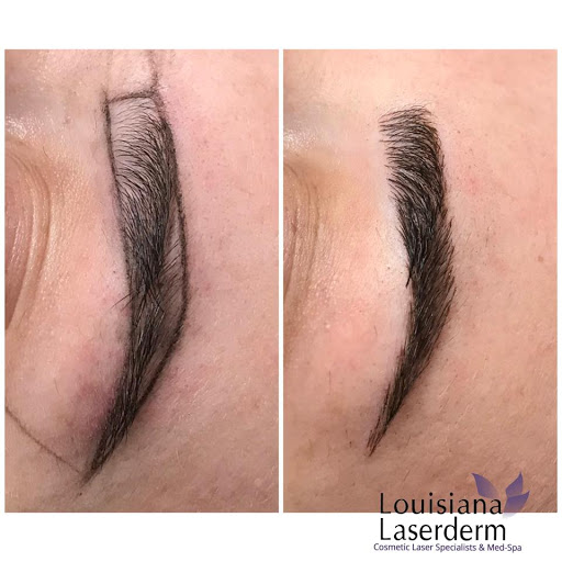 Explore bridge tattoo ideas, creative tattoo ideas in Baton Rouge, available at Louisiana Laserderm