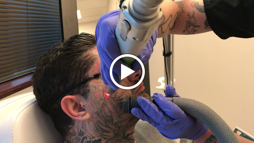 Explore chevrolet tattoo ideas, creative tattoo ideas in Aurora, available at LaserAll