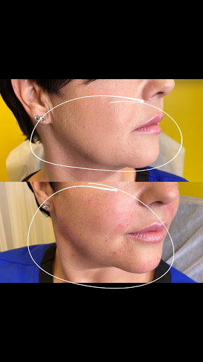Lifted Beauty Medical Practice image