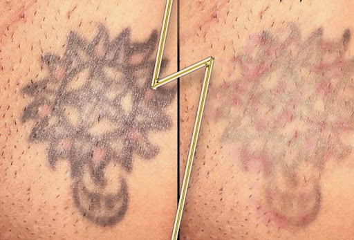 Explore beehive tattoo ideas, creative tattoo ideas in Savannah, available at Haute Brows. Cosmetic Tattoo