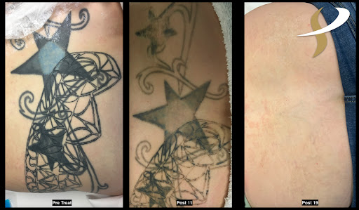 Explore emma tattoo ideas, creative tattoo ideas in Spokane, available at Premier Body and Laser