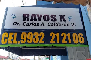 Rayos X. Radiografías a domicilio. "Centro de imágenes radiológicas Dr. Carlos Calderón" image