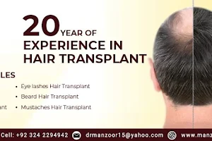 Manzoor Hair Transplant Clinic Karachi | PRP & FUE Clinic image