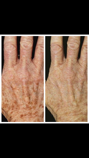 Explore precious moments tattoos ideas, creative tattoo ideas in Tucson, available at Allure Medical