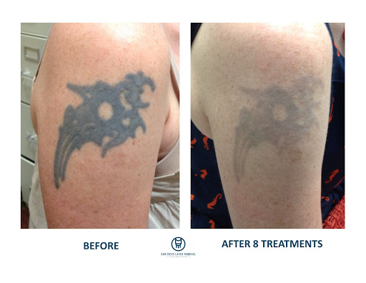 Explore father daughter tattoo ideas small, creative tattoo ideas in San Diego, available at Removery Tattoo Removal & Fading