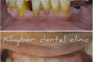 Khyber Dental Clinic image