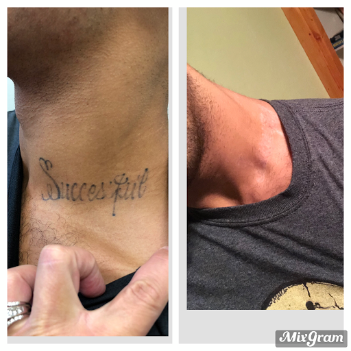 Explore penguin tattoo ideas, creative tattoo ideas in Longview, available at Vanish Laser Aesthetics