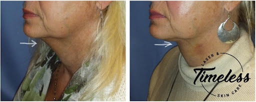 Skin Care Clinic «Timeless Laser & Skin Care», reviews and photos, 29160 Center Ridge Rd, Westlake, OH 44145, USA