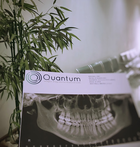 Quantum- Tomografia dental