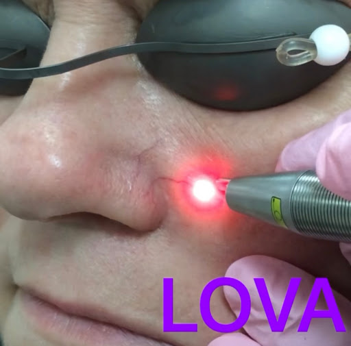 Explore bird family tattoo ideas, creative tattoo ideas in Lake Oswego, available at Lake Oswego Vein and Aesthetic LOVA