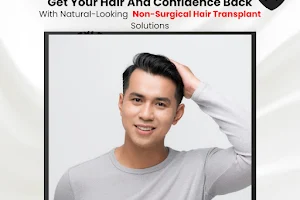 Present to Past Hair Clinic - Best Non-Surgical Hair Transplant in Faridabad image