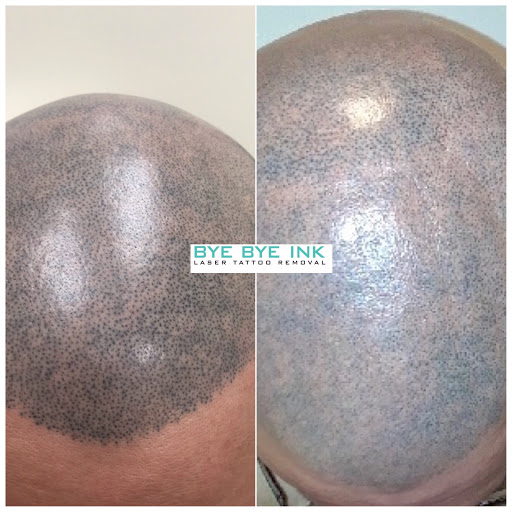 Explore neck word tattoo ideas, creative tattoo ideas in Middle Village, available at Bye Bye Ink Laser Tattoo Removal