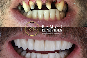 Dr Ramon Benevides - Reabilitação Oral e Estética image