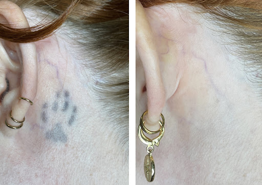 Explore tattoo arm sleeve ideas woman, creative tattoo ideas in Portland, available at Take It Off Tattoo Removal and Alt Spa