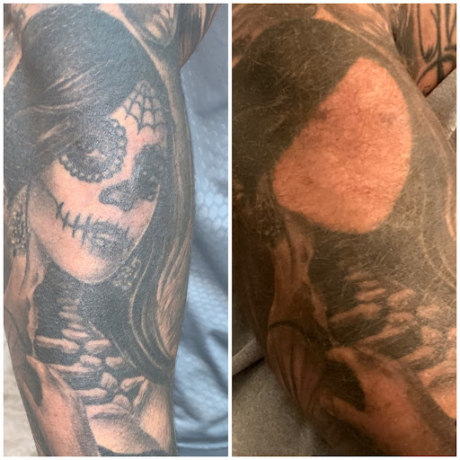 Explore hard tattoo ideas, creative tattoo ideas in Tucson, available at Allure Medical