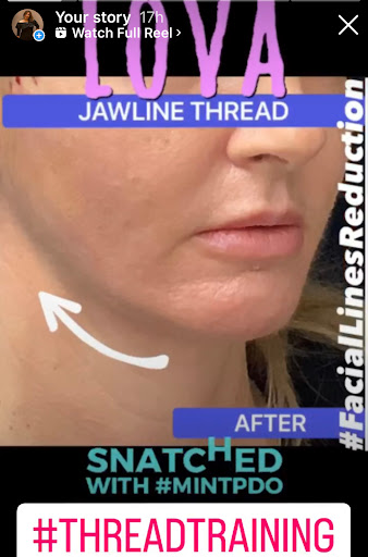 Explore running tattoos ideas, creative tattoo ideas in Lake Oswego, available at Lake Oswego Vein and Aesthetic LOVA