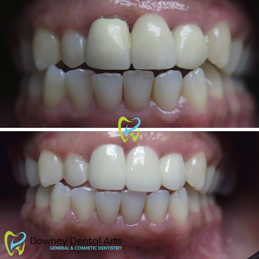 Downey Dental Arts image