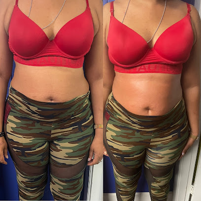 BU2FL BODY CONTOURING