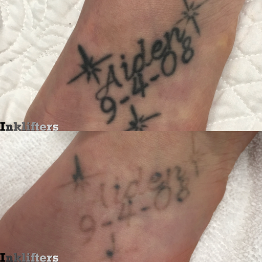 Explore broken tattoo ideas, creative tattoo ideas in Pleasant Grove, available at Inklifters Tattoo Removal