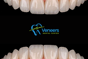 Veneers Dental Center image