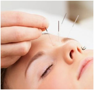 Rezensionen über Dr Gabrielle Franzoni, acupuncteur in Genf - Akupunkteur