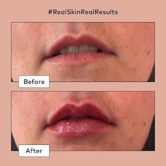 Caci Hamilton - Caci Hamilton